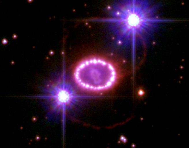 A String of &lsquo;Cosmic Pearls&rsquo; Surrounds an Exploding Star