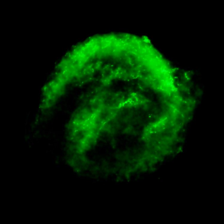 Chandra X-ray Observatory Data of Kepler&rsquo;s Supernova Remnant
