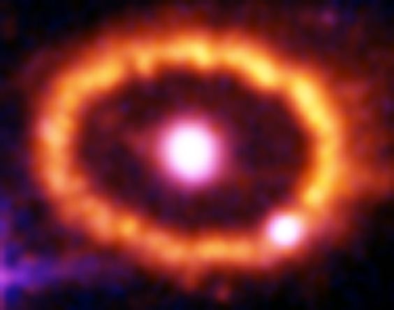 Hubble Supernova 1987A Scrapbook (1994-2003) – Image 2