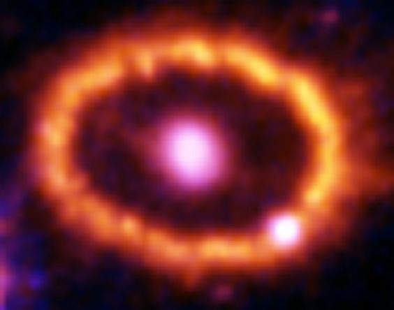 Hubble Supernova 1987A Scrapbook (1994-2003) – Image 3