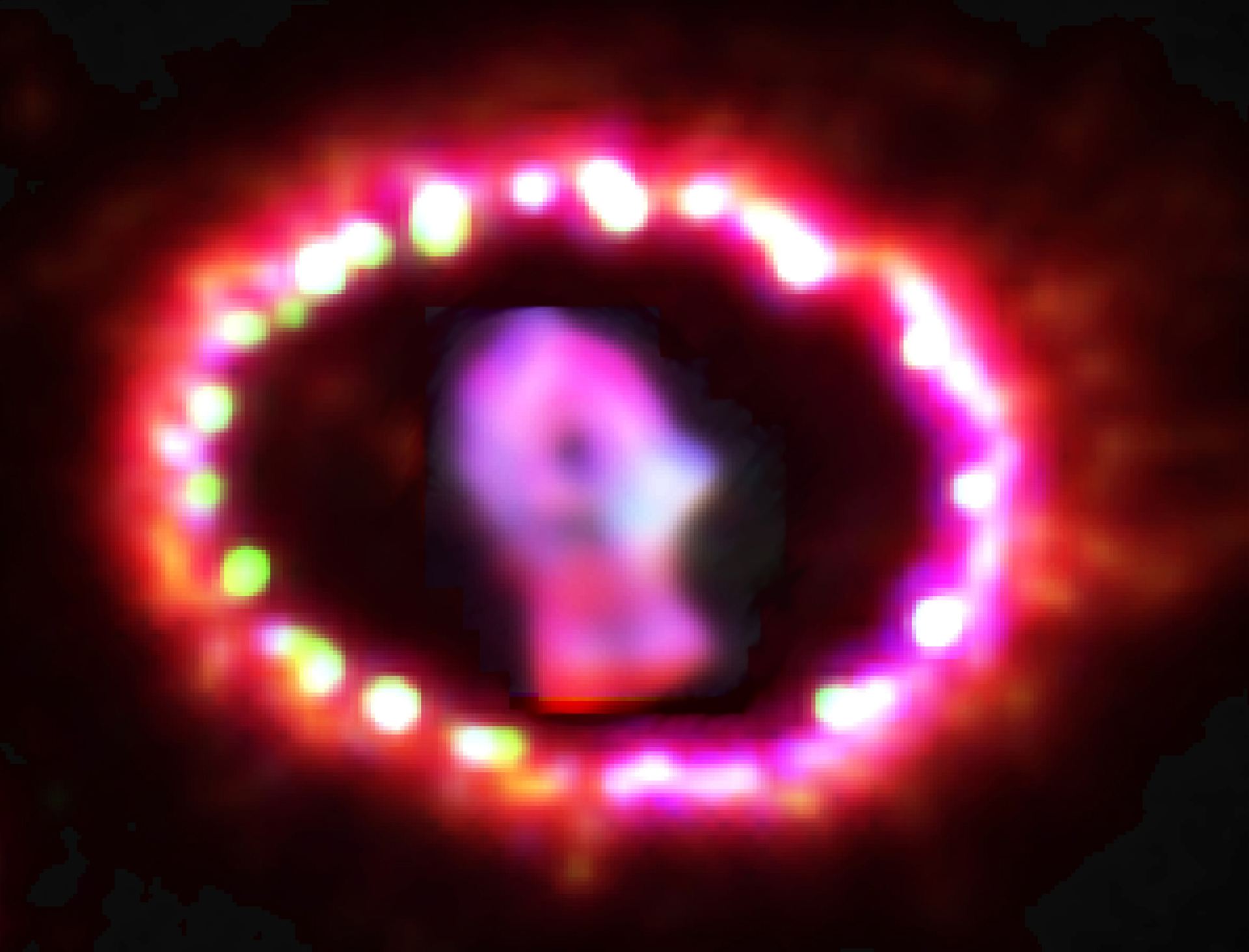 Image of Supernova 1987A