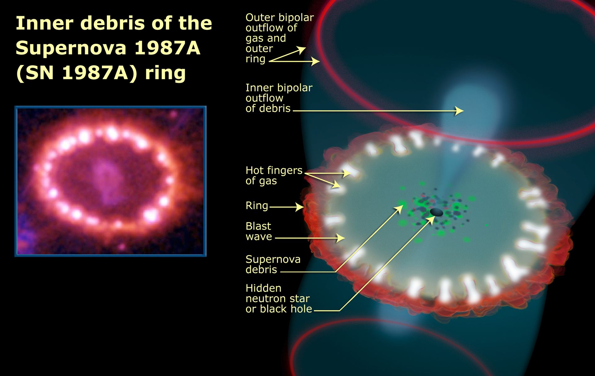 Inner Debris of the Supernova 1987A ring
