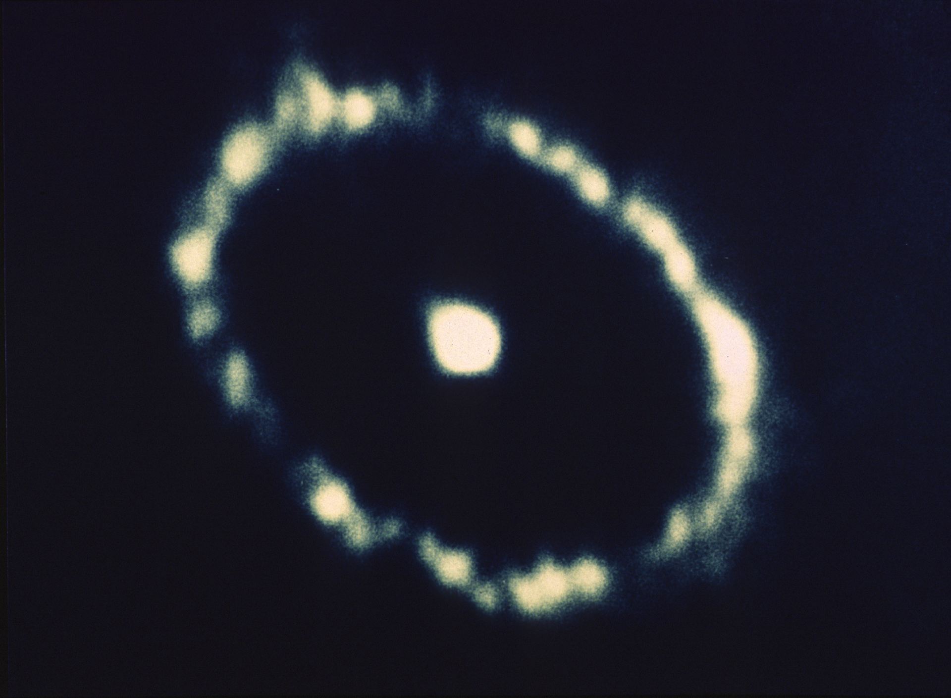 SN1987A