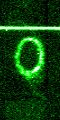 STIS chemically analyzes the ring around SN 1987a