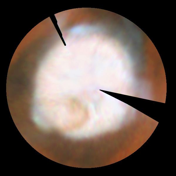 Seasonal Changes In Mars&rsquo; North Polar Ice Cap
